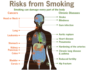 Risks of smoking