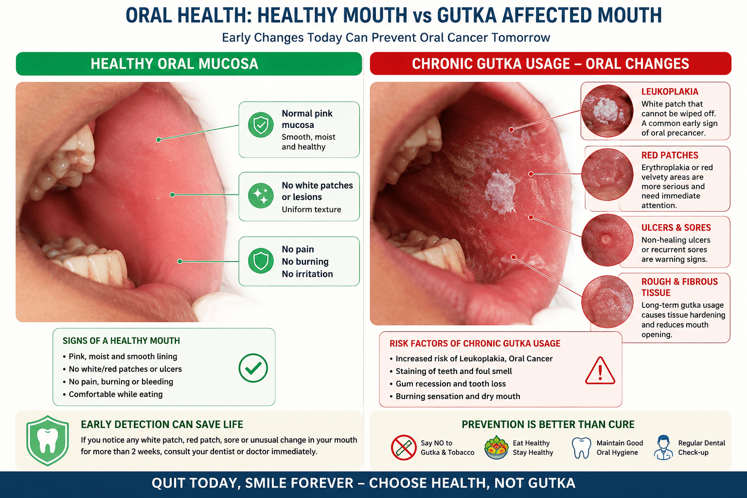 Mouth Ulcers/cancer
